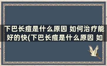 下巴长痘是什么原因 如何治疗能好的快(下巴长痘是什么原因 如何治疗能好得快)